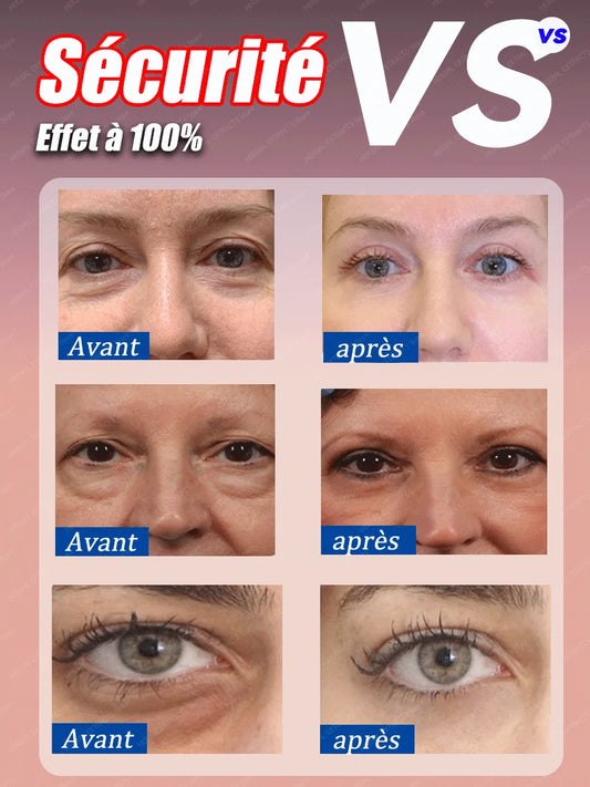 dissolvant pour les yeux gonflés