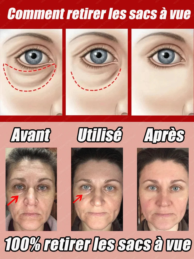 dissolvant pour les yeux gonflés