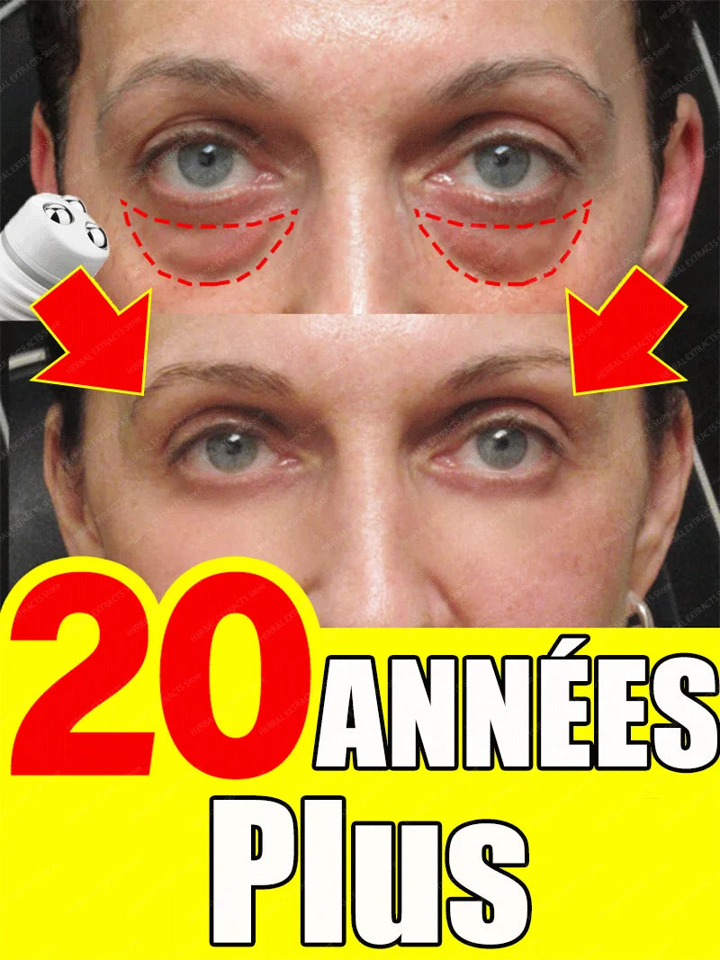 dissolvant pour les yeux gonflés