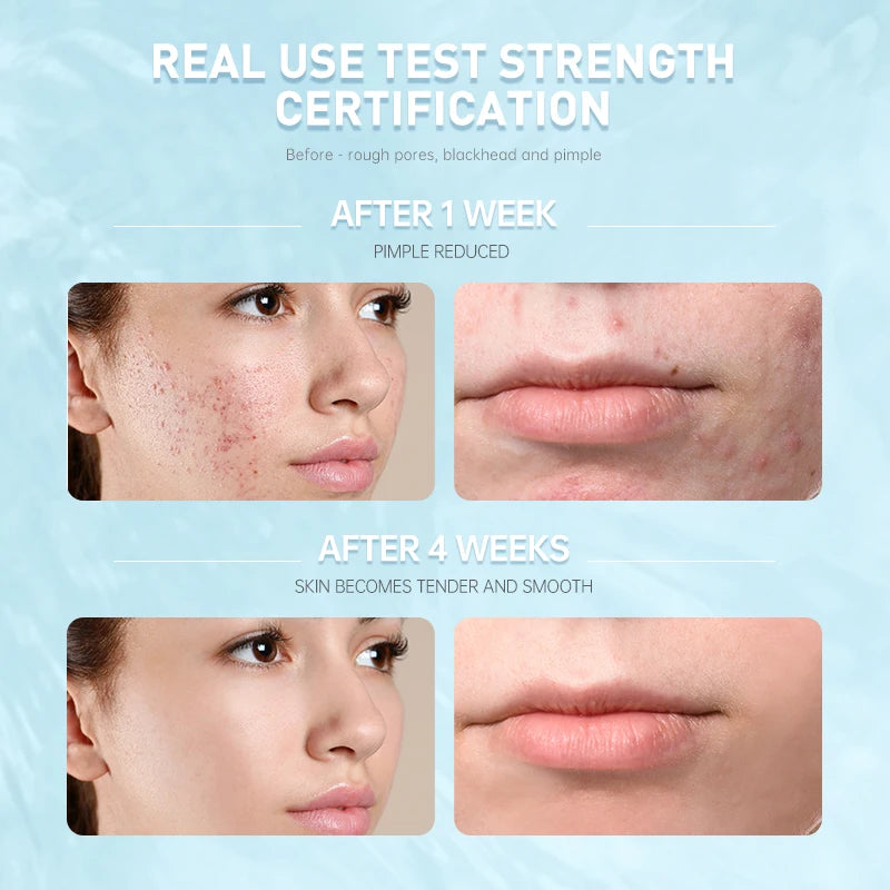 AUCalls-Crème hydratante pour le visage