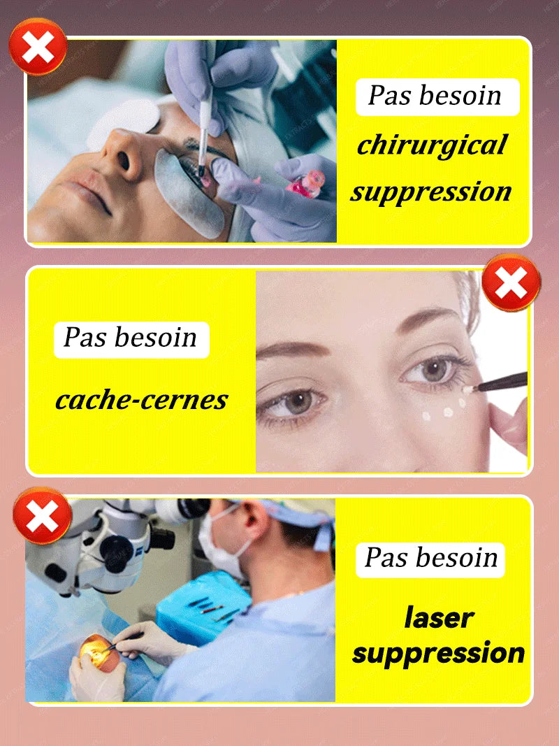 dissolvant pour les yeux gonflés