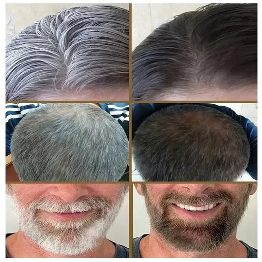 Tueur de cheveux blanche